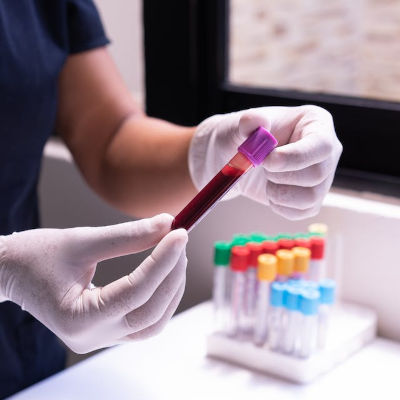 nurse holding blood sample for blood tests for drugs